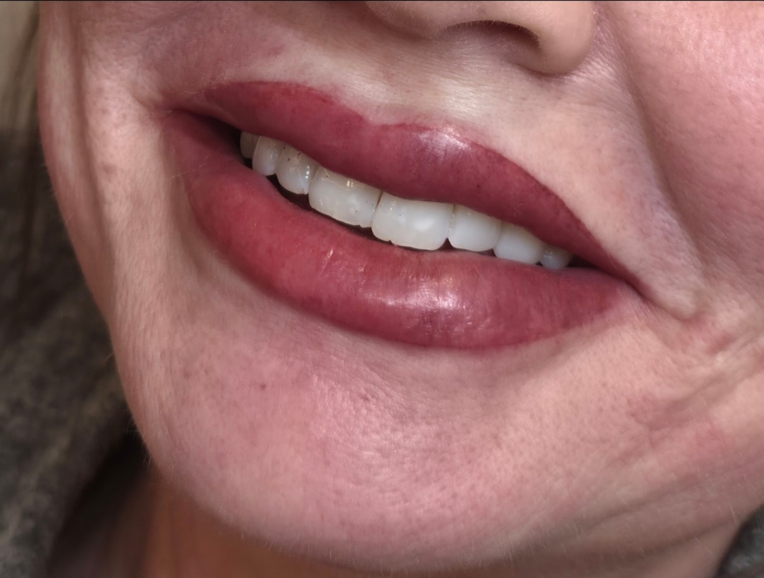 Lip Blush · Healed Result
