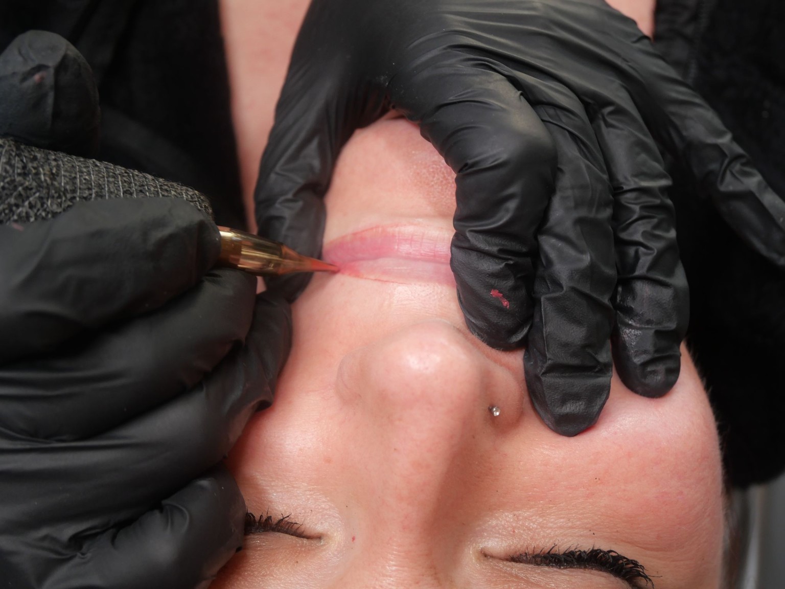 Lip Blush · Treatment in Progress
