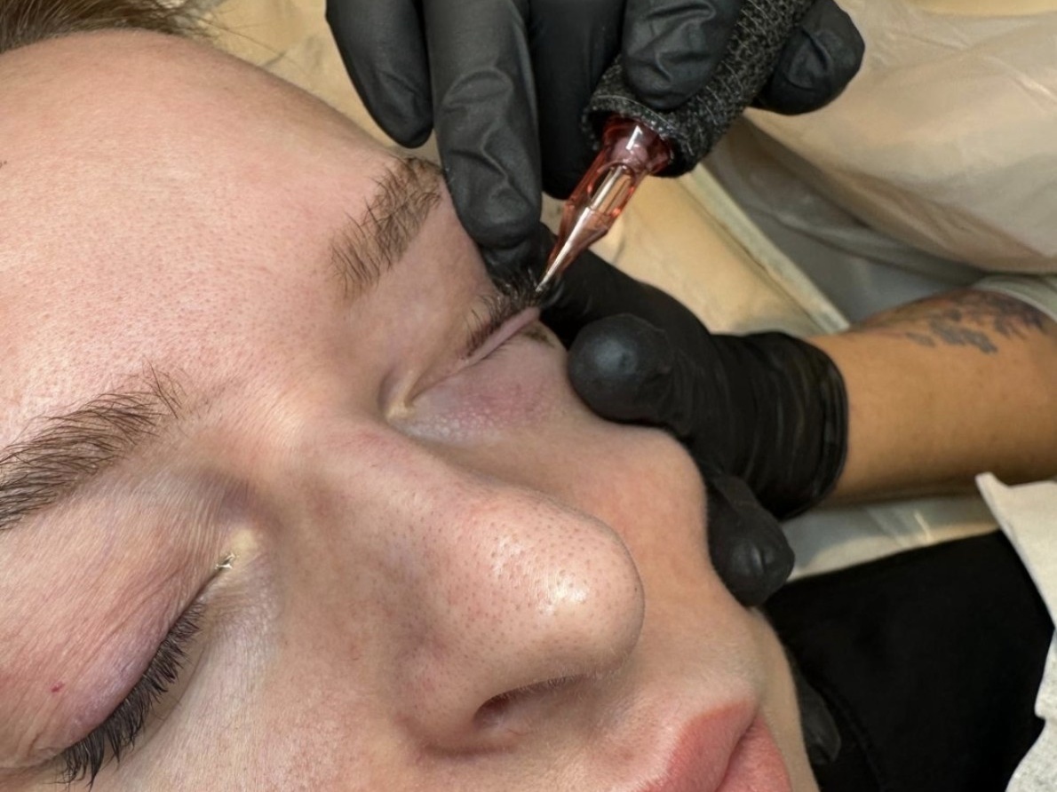 Lip Blush · Treatment in Progress